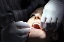A letter writer says dentists limiting NHS patients are causing great upheaval