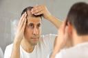 Salisbury named the number one city for hair loss in the UK
