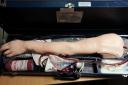 Stolen prosthetic arm discovered in a second hand shop